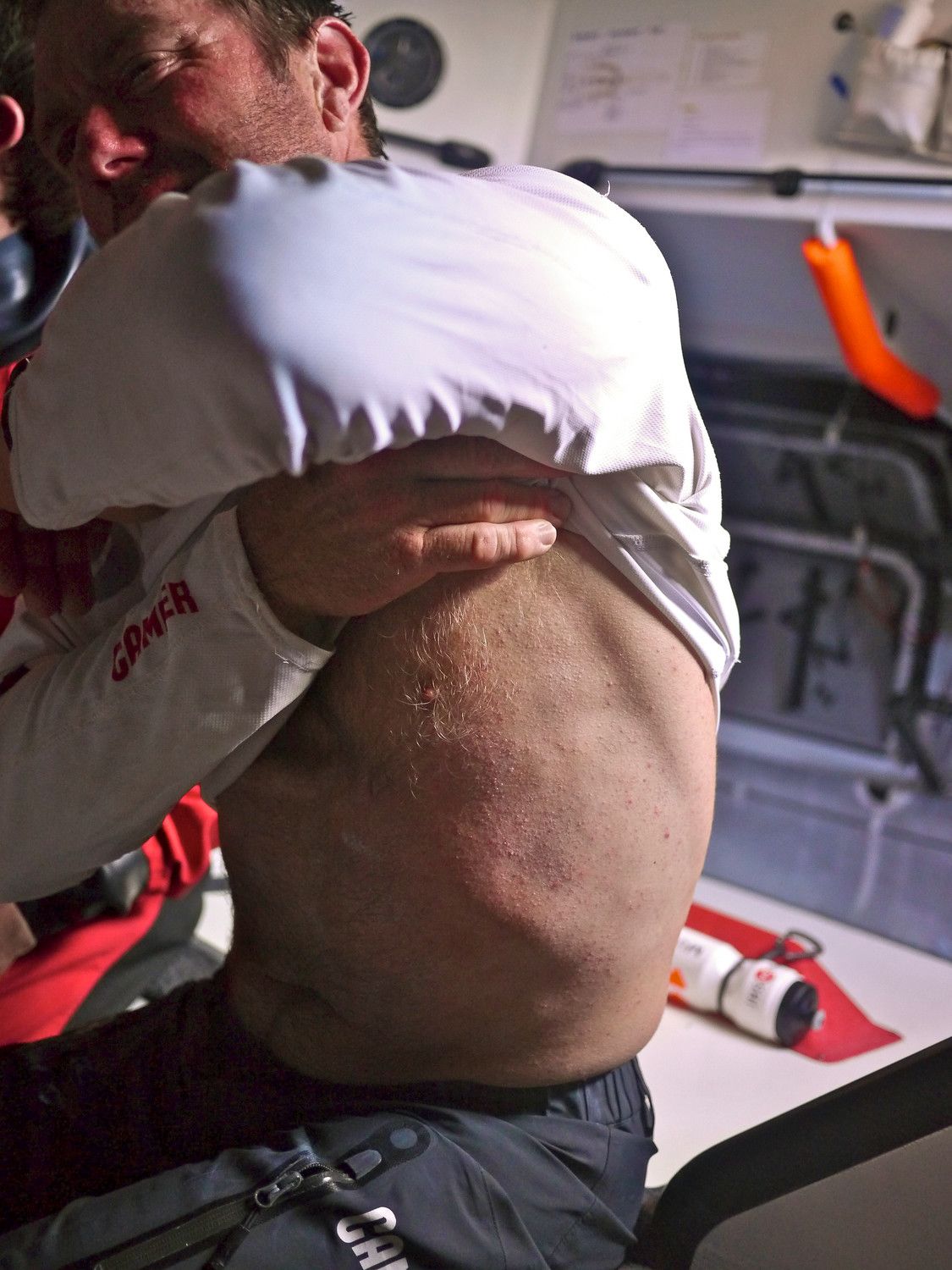 ...schleudern die Segler schon mal durch das Cockpit. Tony Rae von Camper zeigt seine Rippen-Verletzung. An der Spitze...© Hamish Hooper/CAMPER ETNZ/Volvo Ocean Race