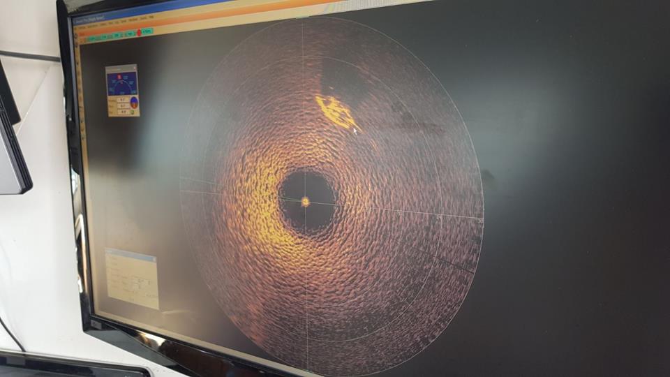 Das Sonar-Bild mit dem die “JLAG” gefunden wurde. © Gruppo Volontari Del Garda J/24 Untergang